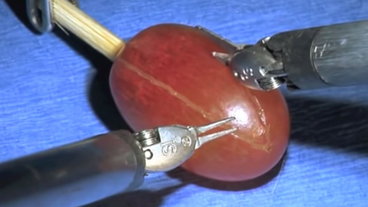 They Performed Surgery On A Grape